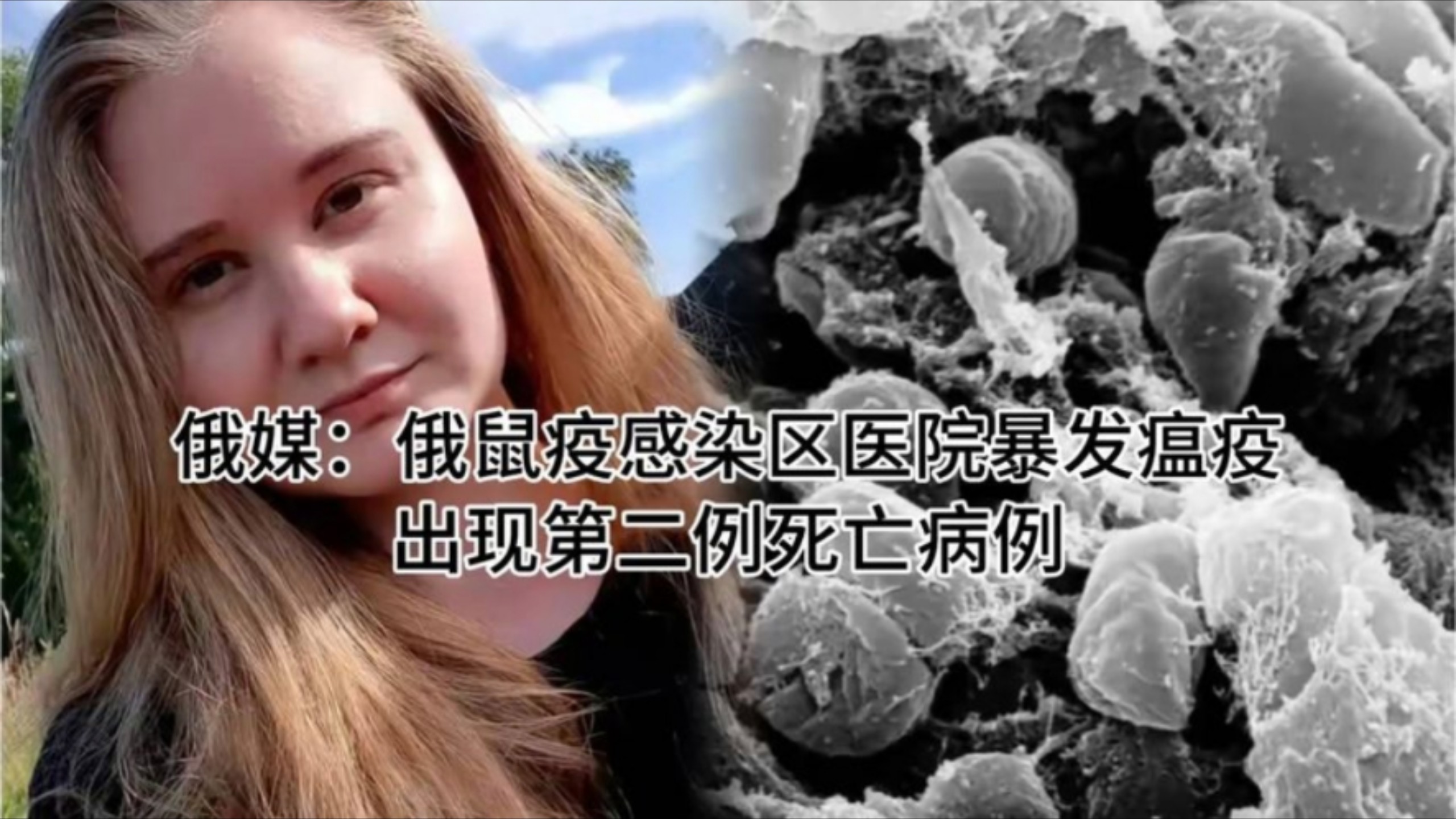 俄媒：俄鼠疫感染区医院暴发瘟疫，出现第二例死亡病例