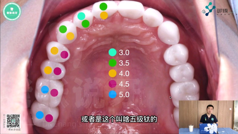 口腔种植相关解剖知识——张林线上种植课哔哩哔哩bilibili