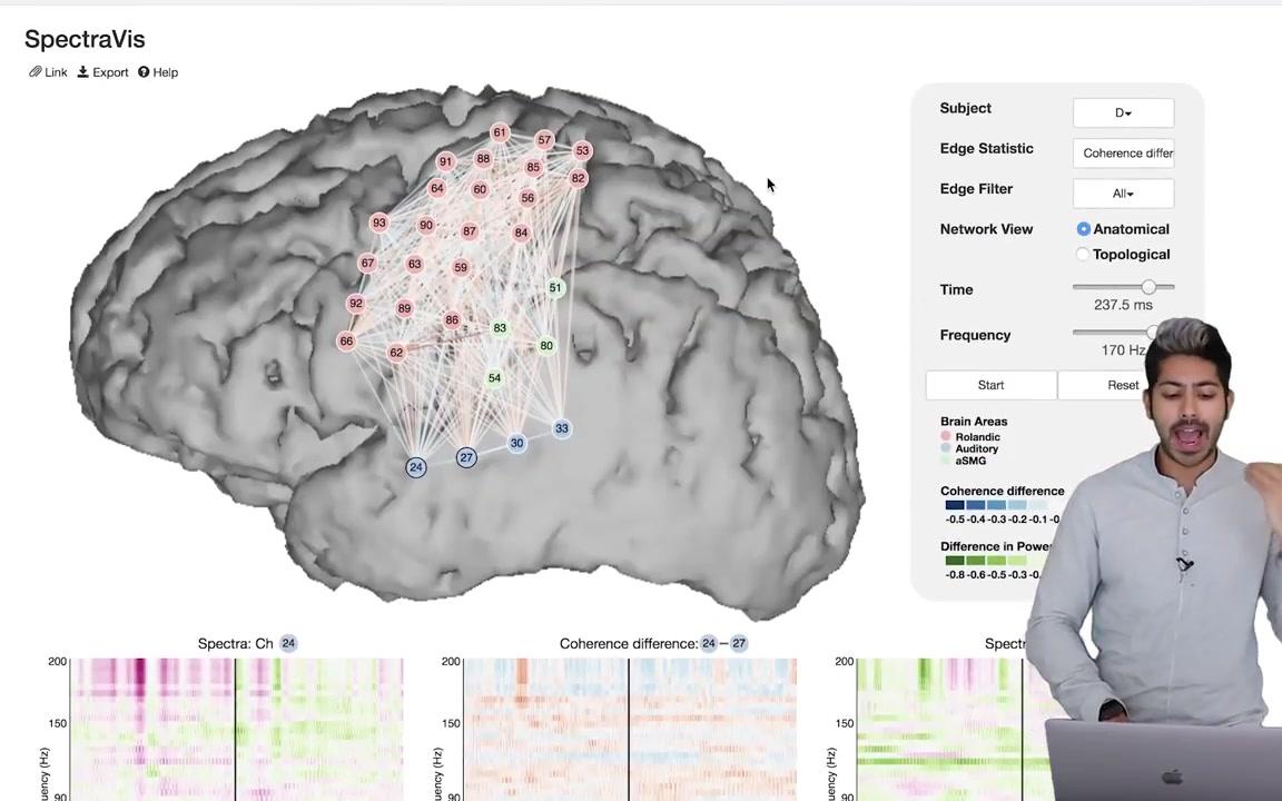 【 机器学习 】机器学习与神经科学 Machine Learning & Neuroscience(英文)哔哩哔哩bilibili