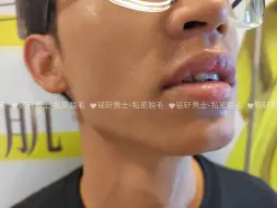 Download Video: 【北京男士脱毛】我的最新作品，快来一睹为快！