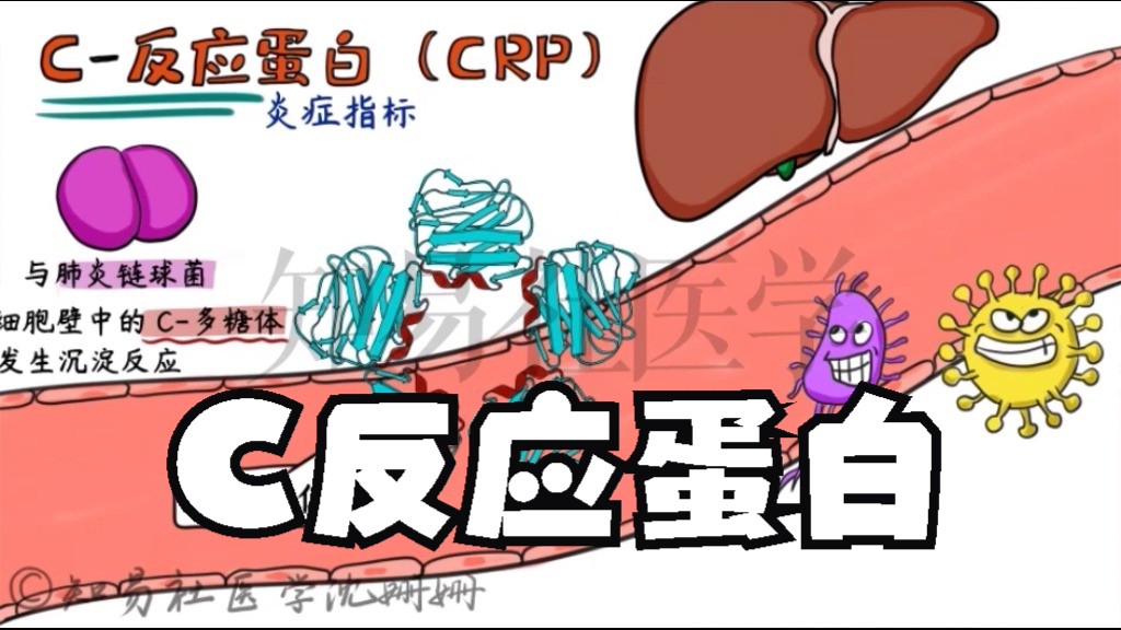 手绘精讲 | C反应蛋白 (CRP)哔哩哔哩bilibili