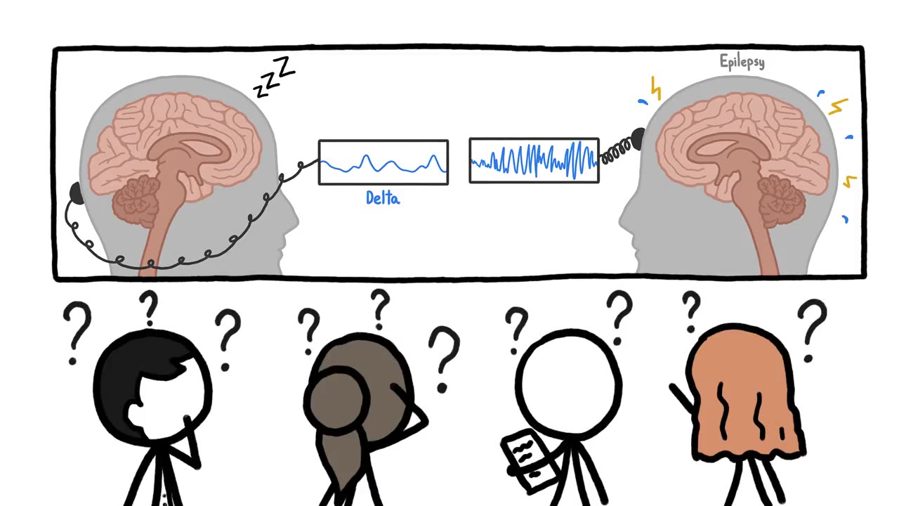 脑电波是什么鬼?