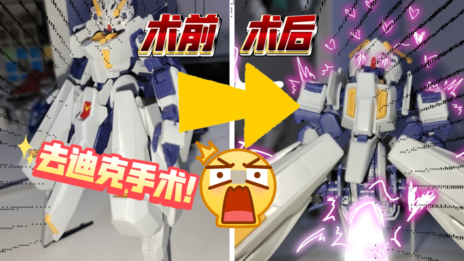 小楠娘tr6·伍德沃特,去迪克手术大揭秘🤯