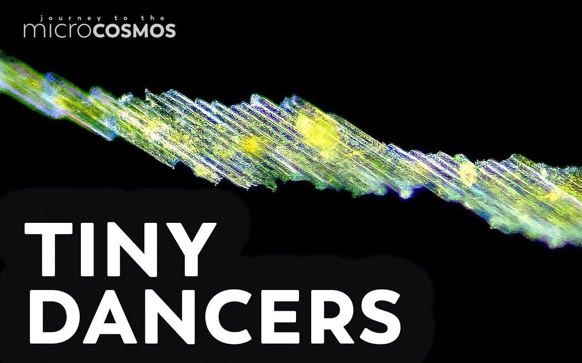 【微观之旅】会跳舞的美丽棍形藻~ 想不到藻类还可以这样运动-窝嘟纸