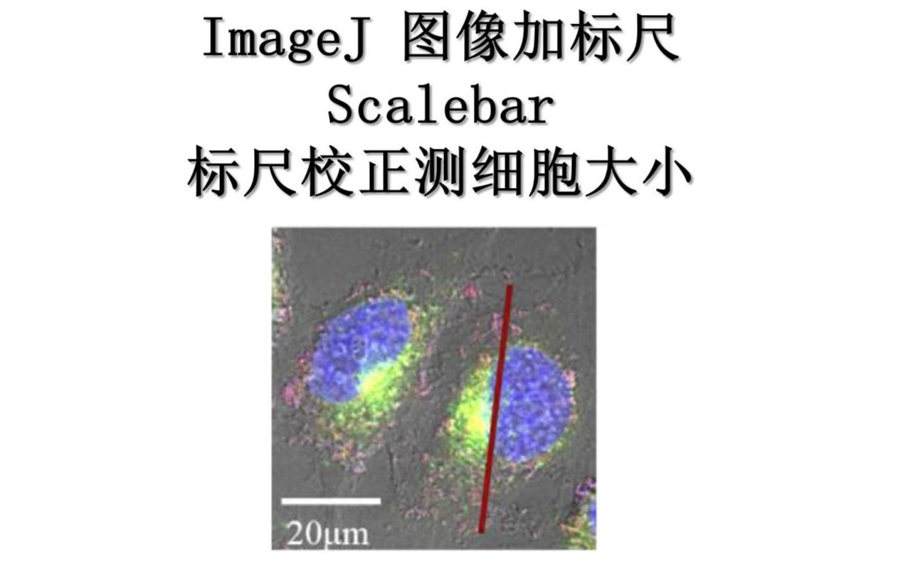 【科研绘图】ImageJ图像加标尺scalebar并用标尺校正图片尺寸测量细胞大小哔哩哔哩bilibili