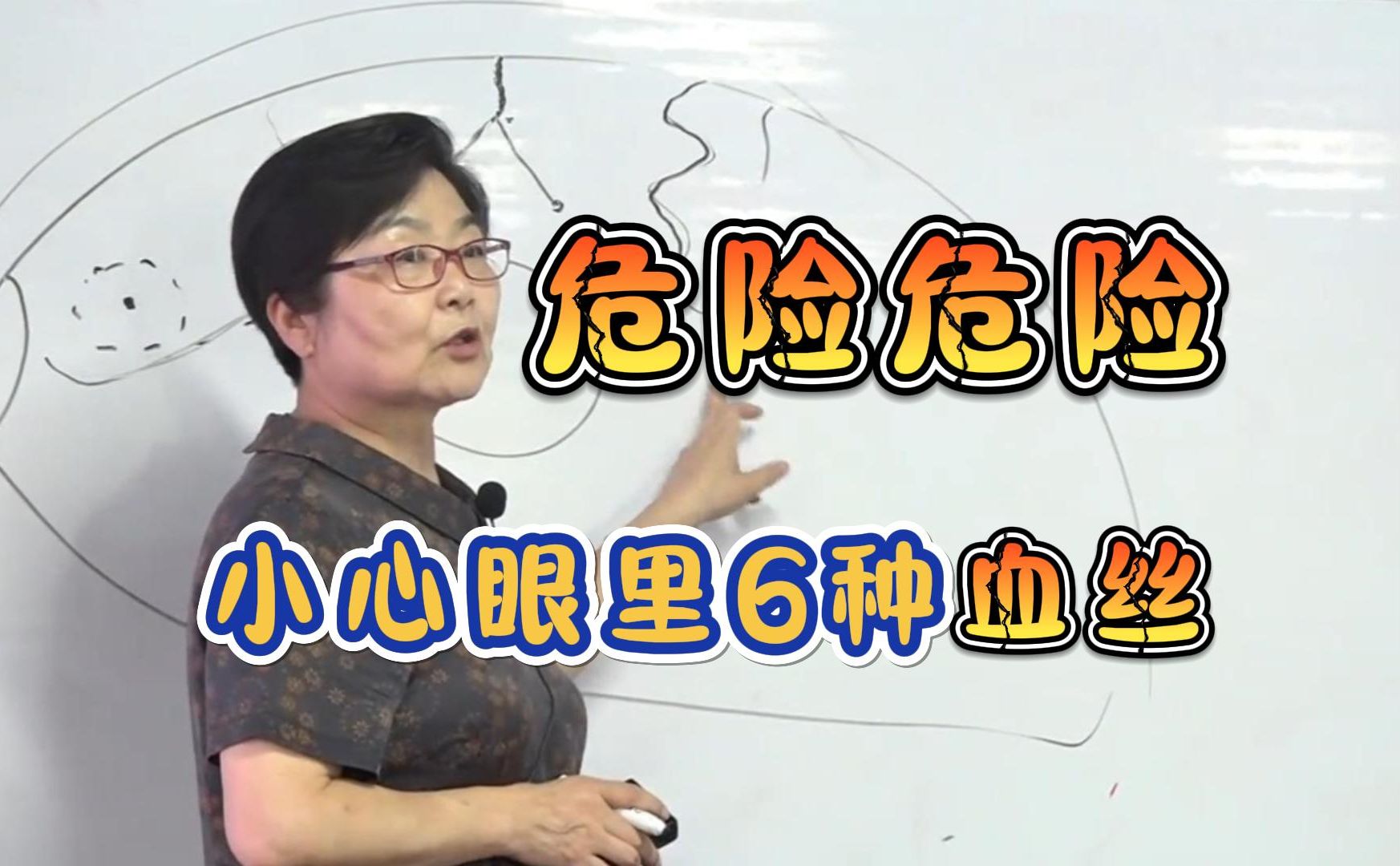 目诊:眼里的这6种血丝,一定要注意!危险来临前兆,吕丽五维综合望诊教学哔哩哔哩bilibili