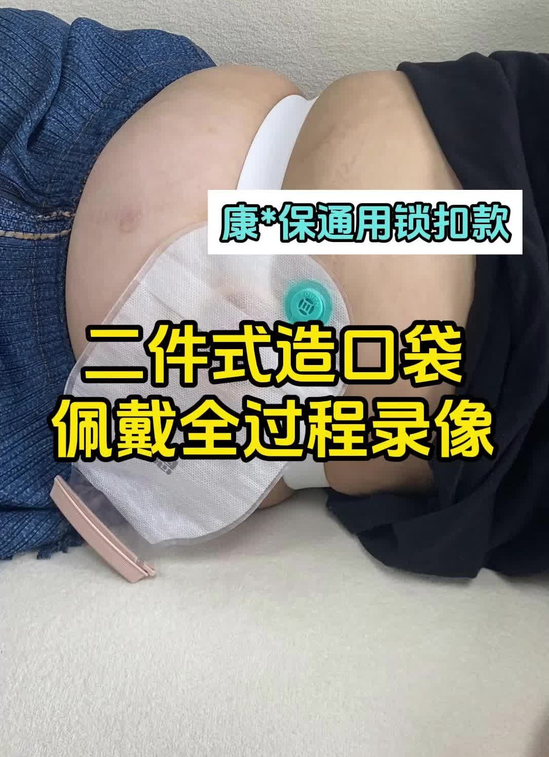 二件式造口袋佩戴全过程录像康*保通用款哔哩哔哩bilibili