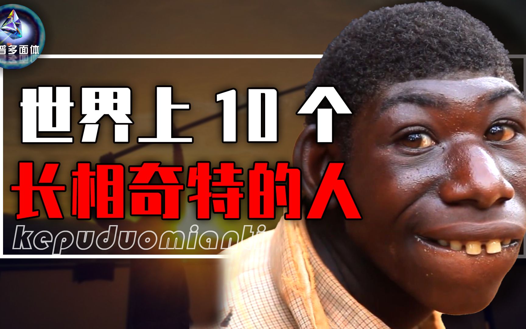 世界上长相奇特的9个人,猴子男孩,大胡子女人,你绝对没见过!