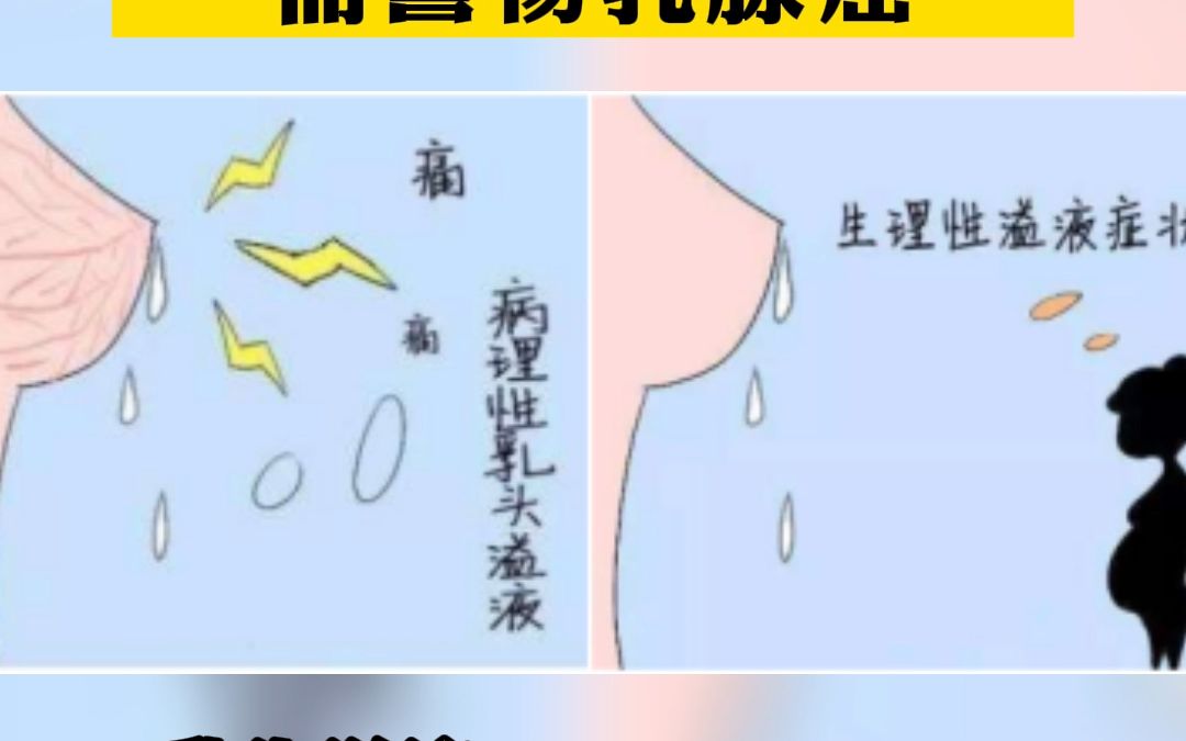 乳腺出现这5点变化需警惕乳腺癌