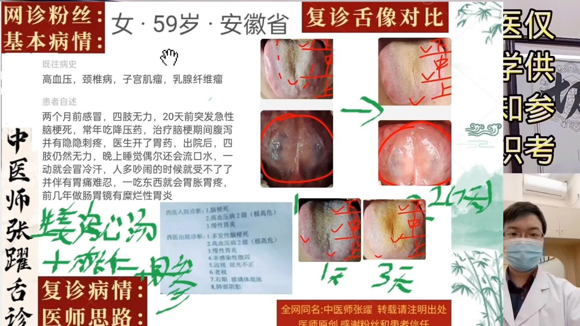 [图]急性脑梗后遗 腹胀腹泻胃痛 中医舌诊