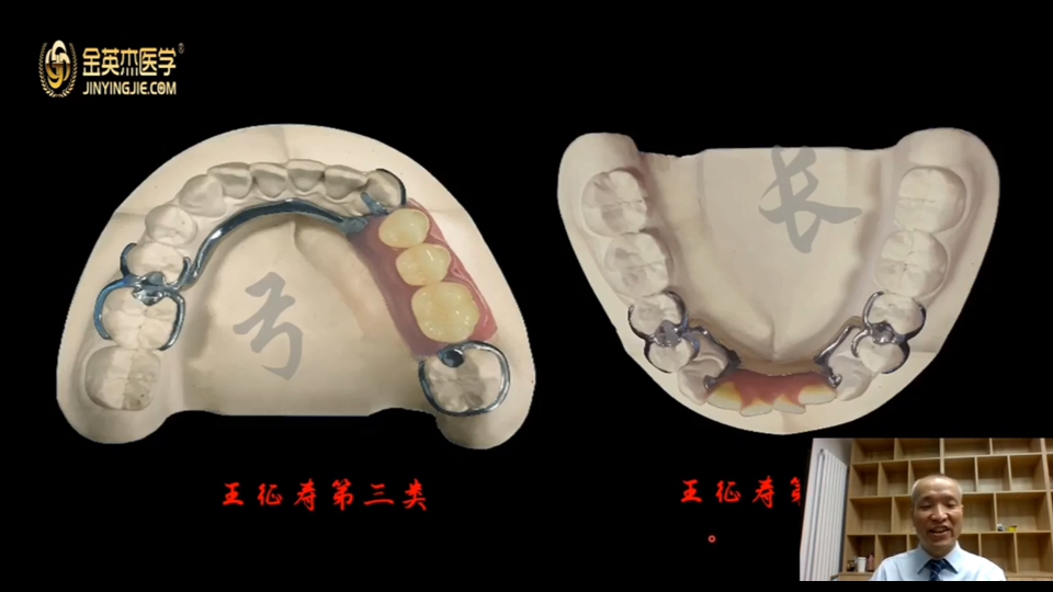 活动义齿制作01哔哩哔哩bilibili