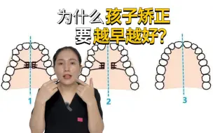 下载视频: 为什么孩子矫正要越早做效果越好？