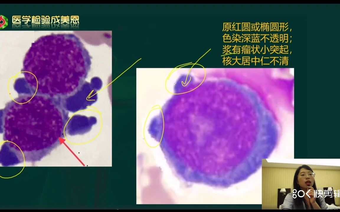 [图]医学检验成美恩老师的【顺口溜】帮你记住爱考的【原始红细胞】