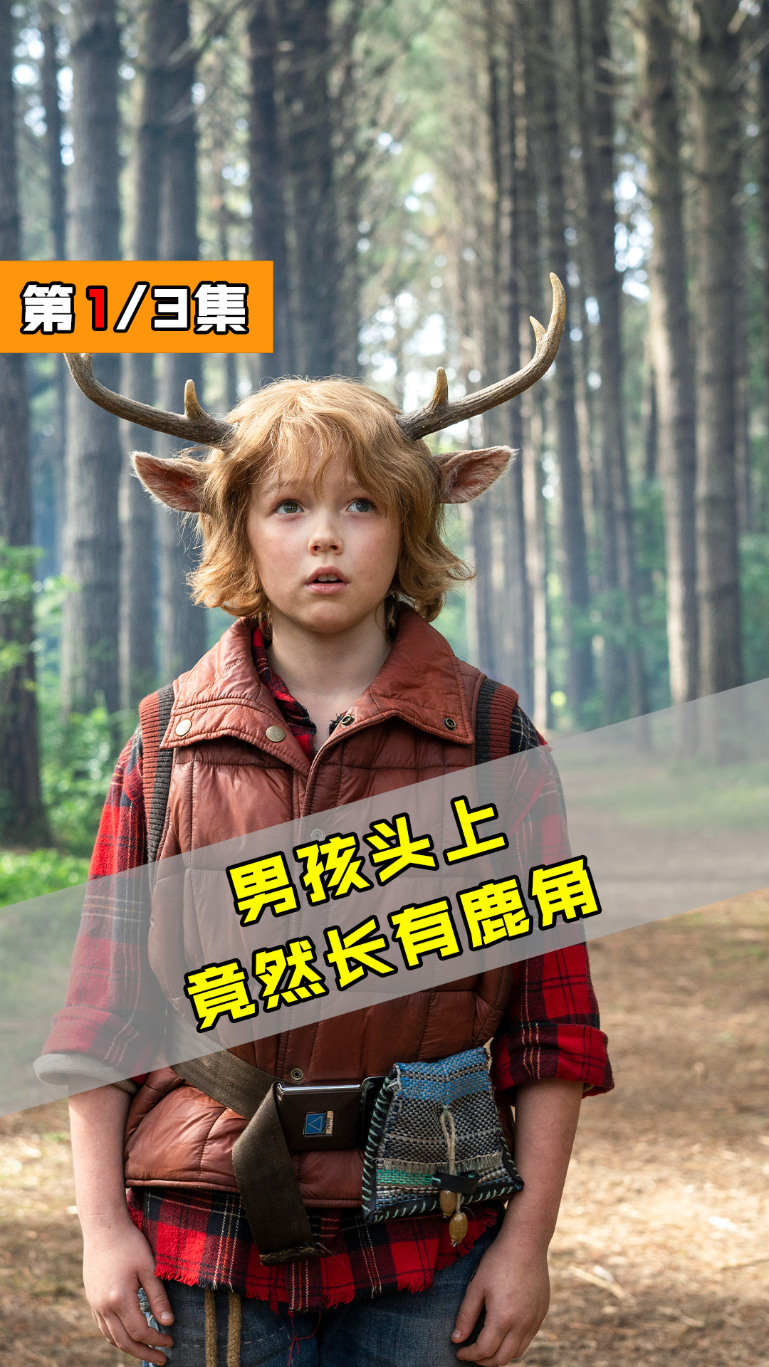 神秘病毒席卷全球,男孩出生竟长着一对鹿角!