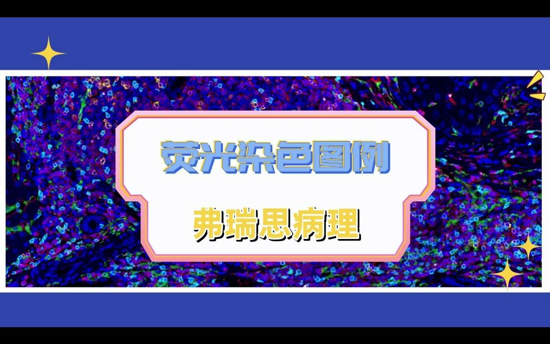 弗瑞思病理多色免疫荧光染色图例哔哩哔哩bilibili