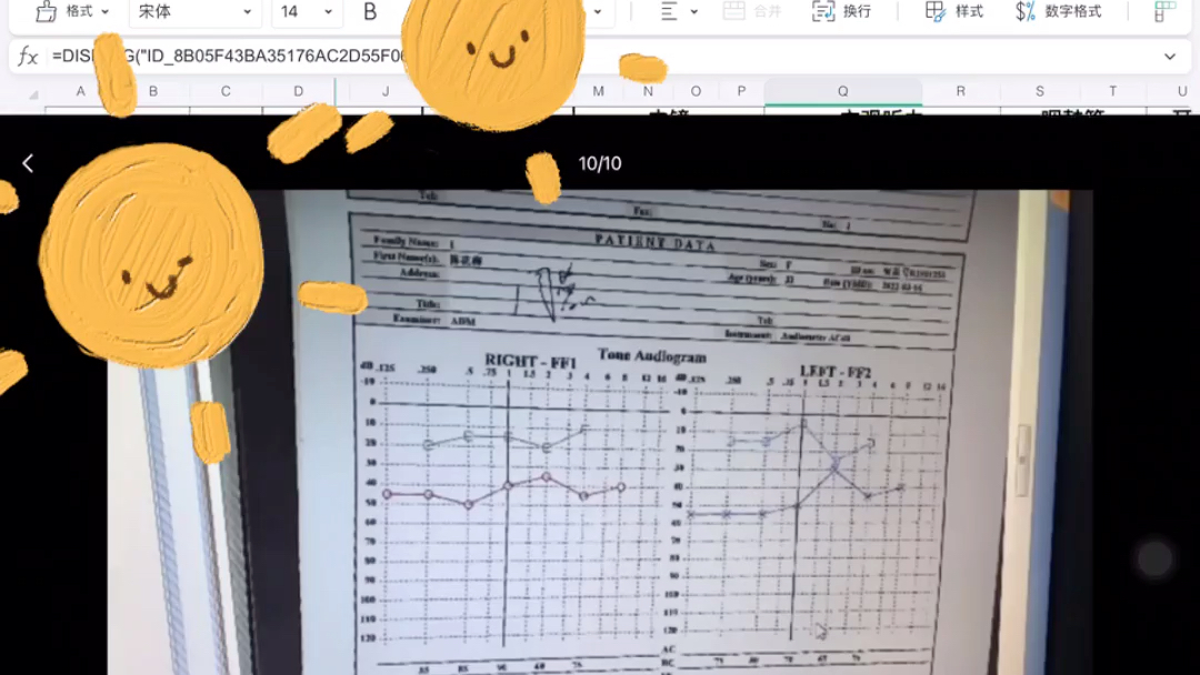 耳鼻喉科医学生规培生活哔哩哔哩bilibili