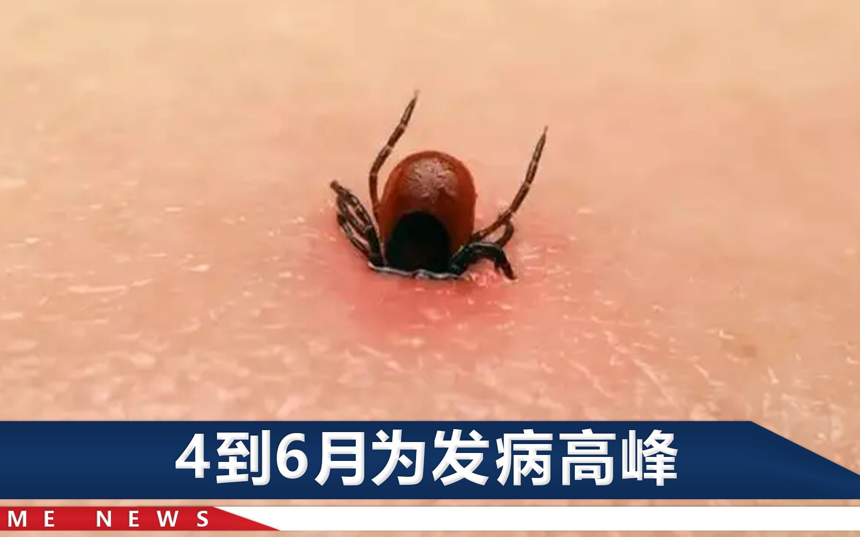 河南3人因蜱虫病去世,曾为死者净身穿寿衣,如何预防这种疾病?