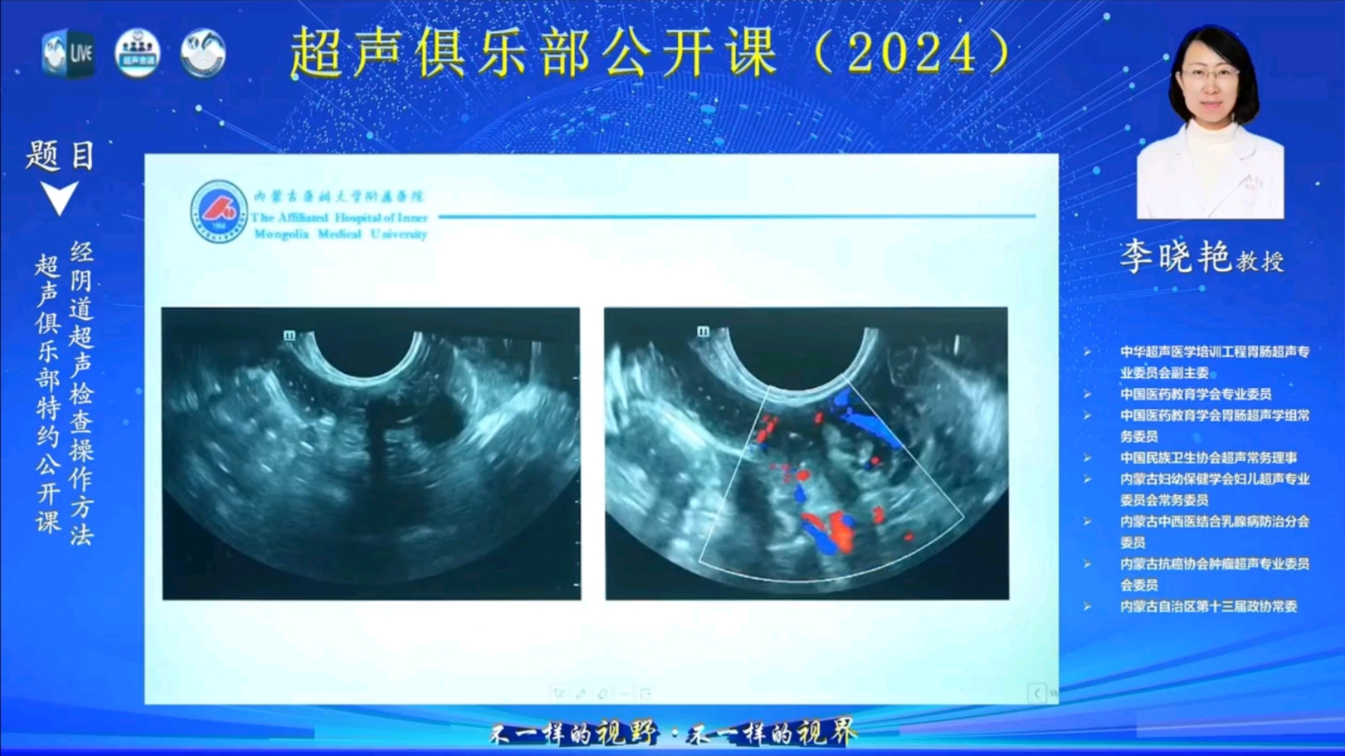 【自用】经阴道超声检查操作方法哔哩哔哩bilibili