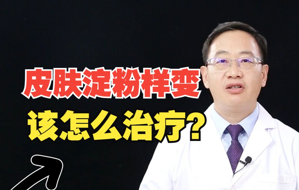 得了皮肤淀粉样变,该怎么治疗?哔哩哔哩bilibili