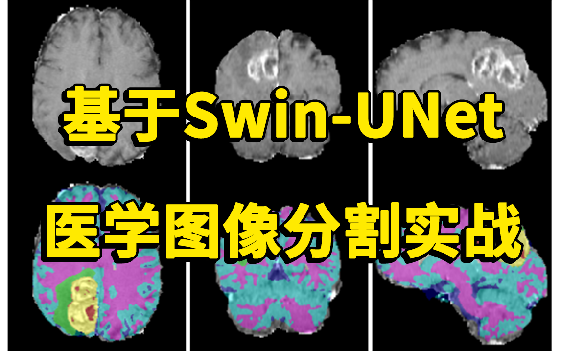 基于SwinUNet模型的医学图像分割实战,同济大佬带你两小时搞懂基于纯Transformer结构的语义分割网络,看完就可以跑通!哔哩哔哩bilibili