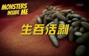 Download Video: 【纪录片】体内怪物 第八季 Monsters Inside Me (Season 8) 02