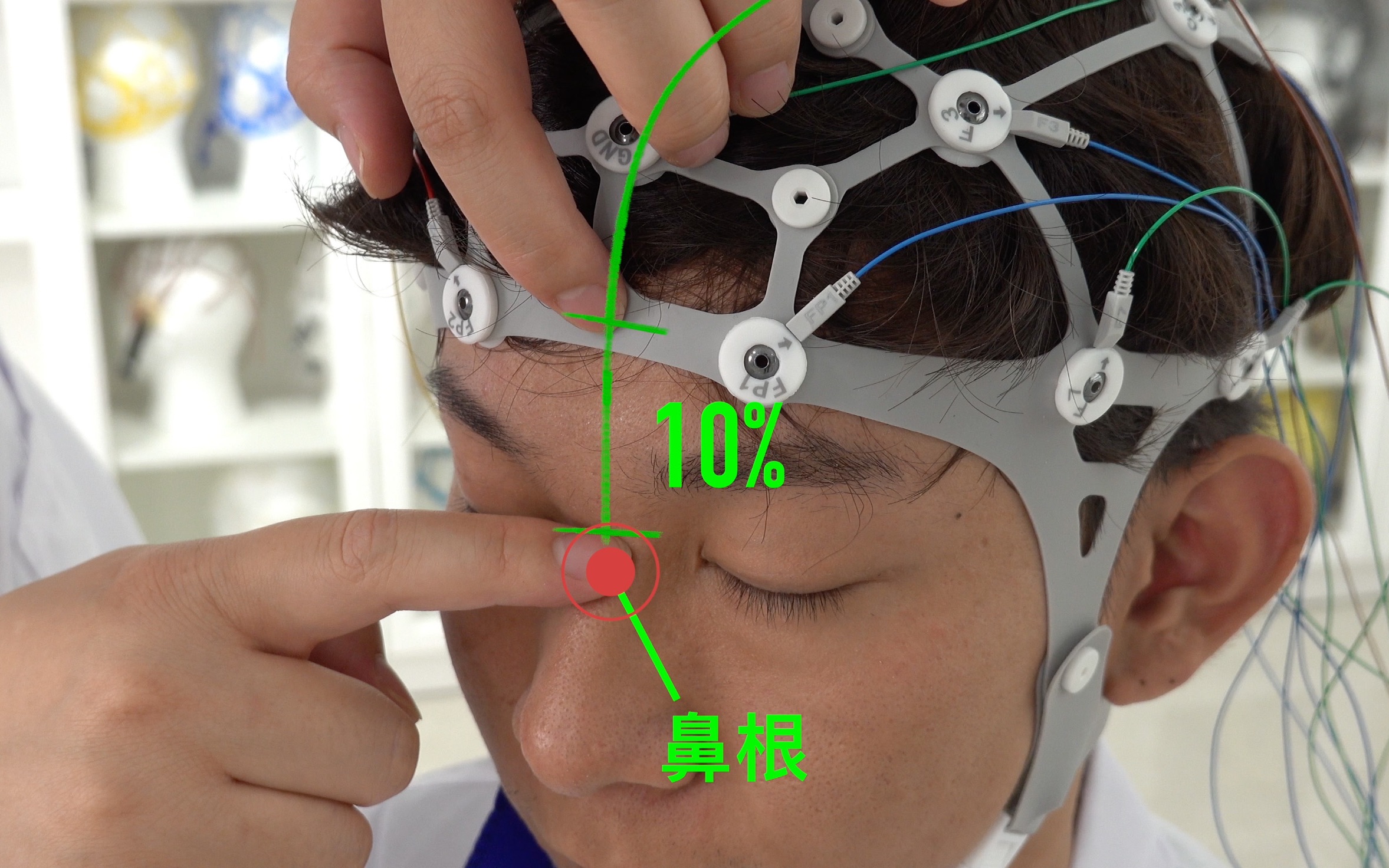 脑电图佩戴示意图图片