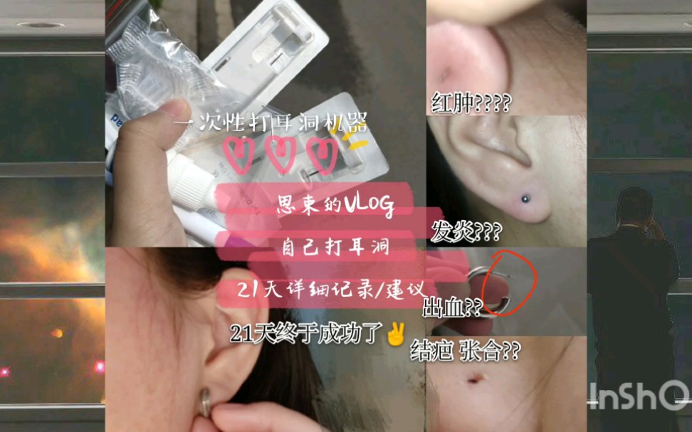 【思束的VLOG】用一次性打耳器自己给自己打耳洞是什么体验? 21天打耳洞记录/分享/发炎过敏张合哔哩哔哩bilibili