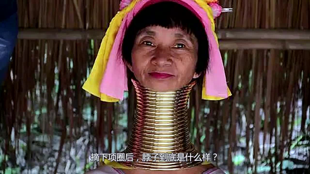 戴了10年项圈的长颈族女人,摘下项圈后,脖子到底是什么样?