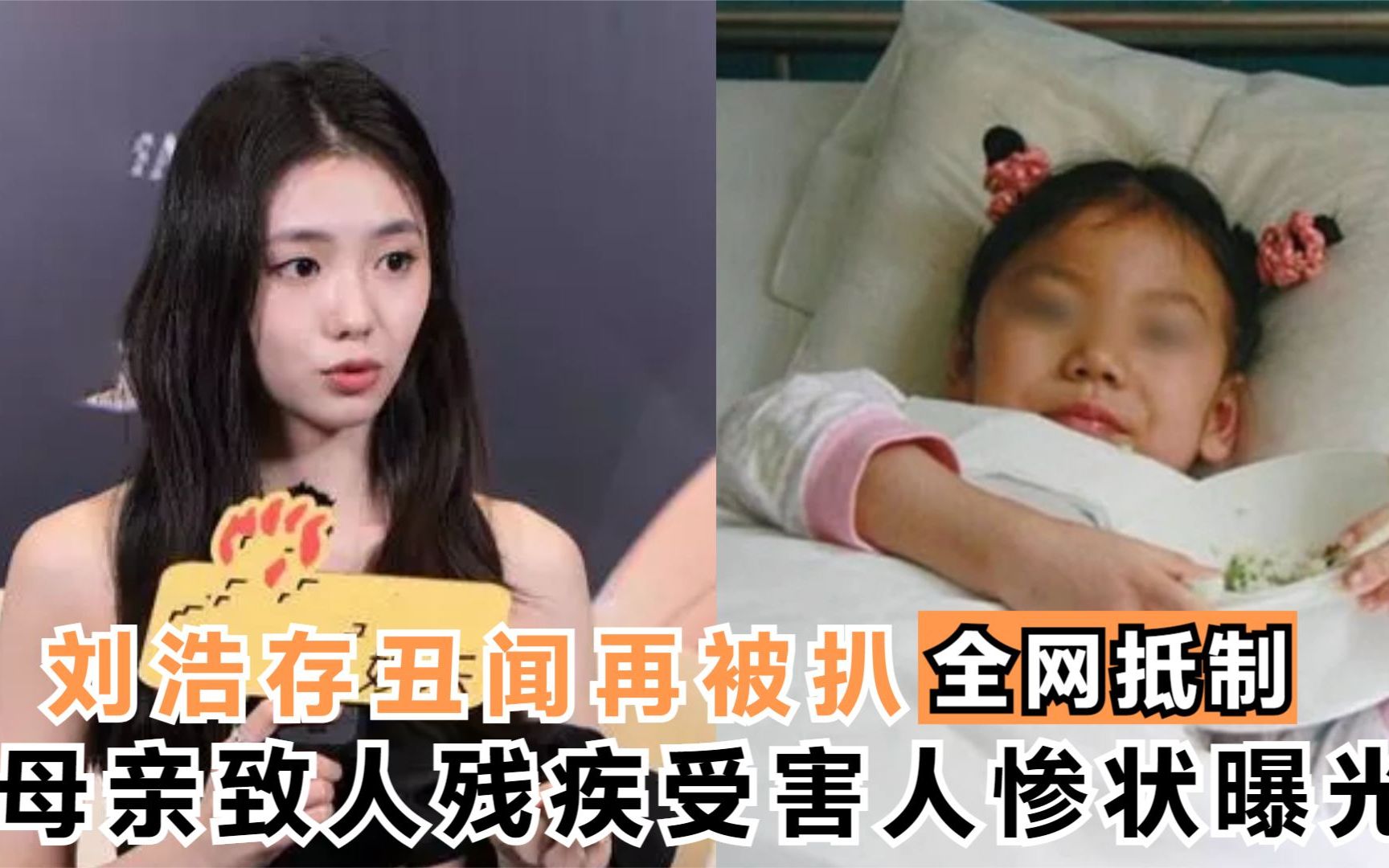 丑闻曝光！刘浩存母亲利益熏心致人残疾，受害人惨状被扒人神共愤