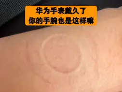 Télécharger la video: 被华为手表压迫下的铁腕^_^