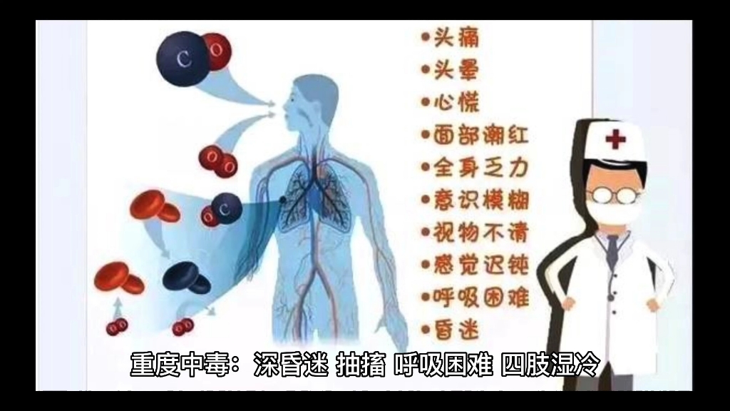 一氧化碳中毒的临床表现哔哩哔哩bilibili