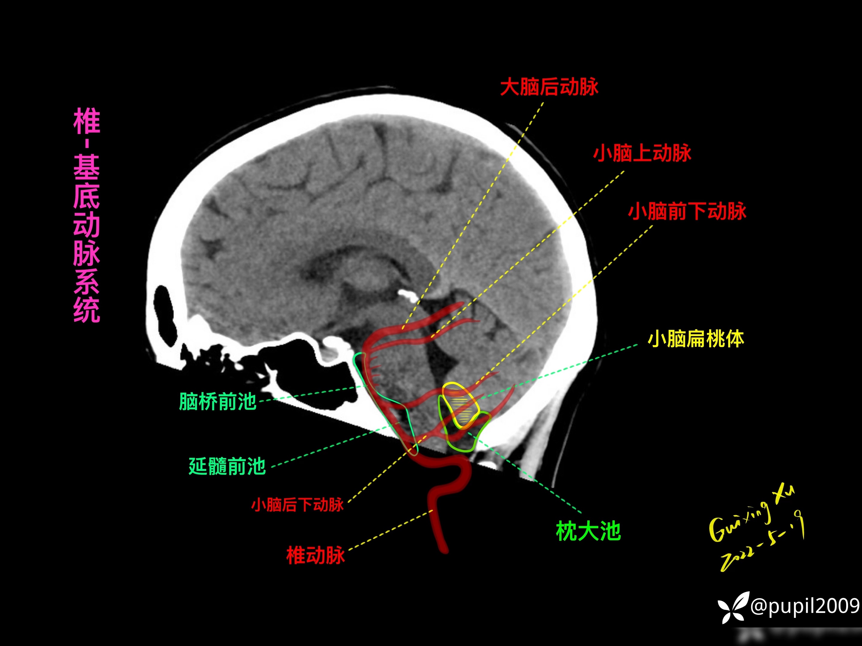 额极动脉图片