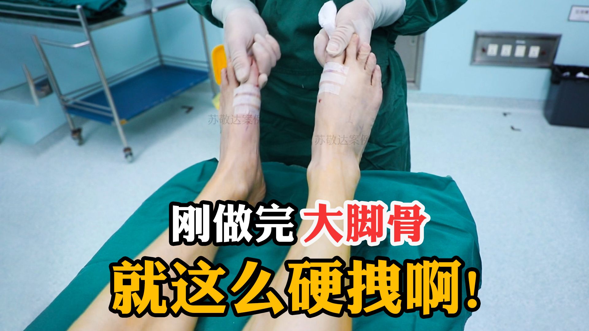 【大脚骨苏敬达】大哥刚做完大脚骨手术就被医生这样拽,不敢相信没打