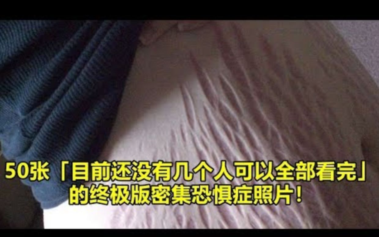 [图]50张「目前还没有几个人可以全部看完」的终极版密集恐惧症照片！