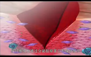 Download Video: 软组织损伤修复过程