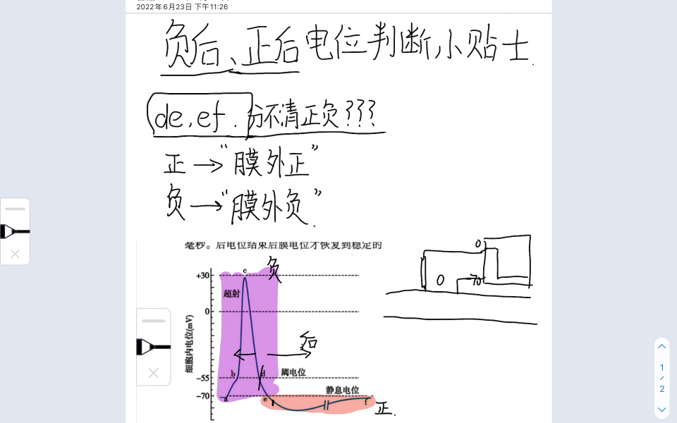 负后、正后电位判断小贴士哔哩哔哩bilibili