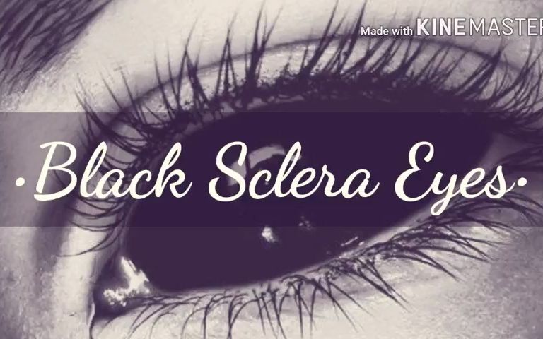 [图]【搬运丨纱布】Black Sclera Eyes