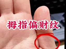 Descargar video: 拇指有偏财纹得手相