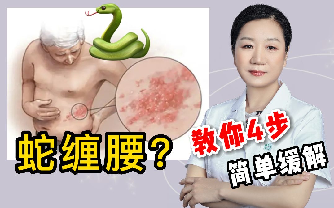 [图]得了缠腰龙疼痛难忍？简单3步教你解决~