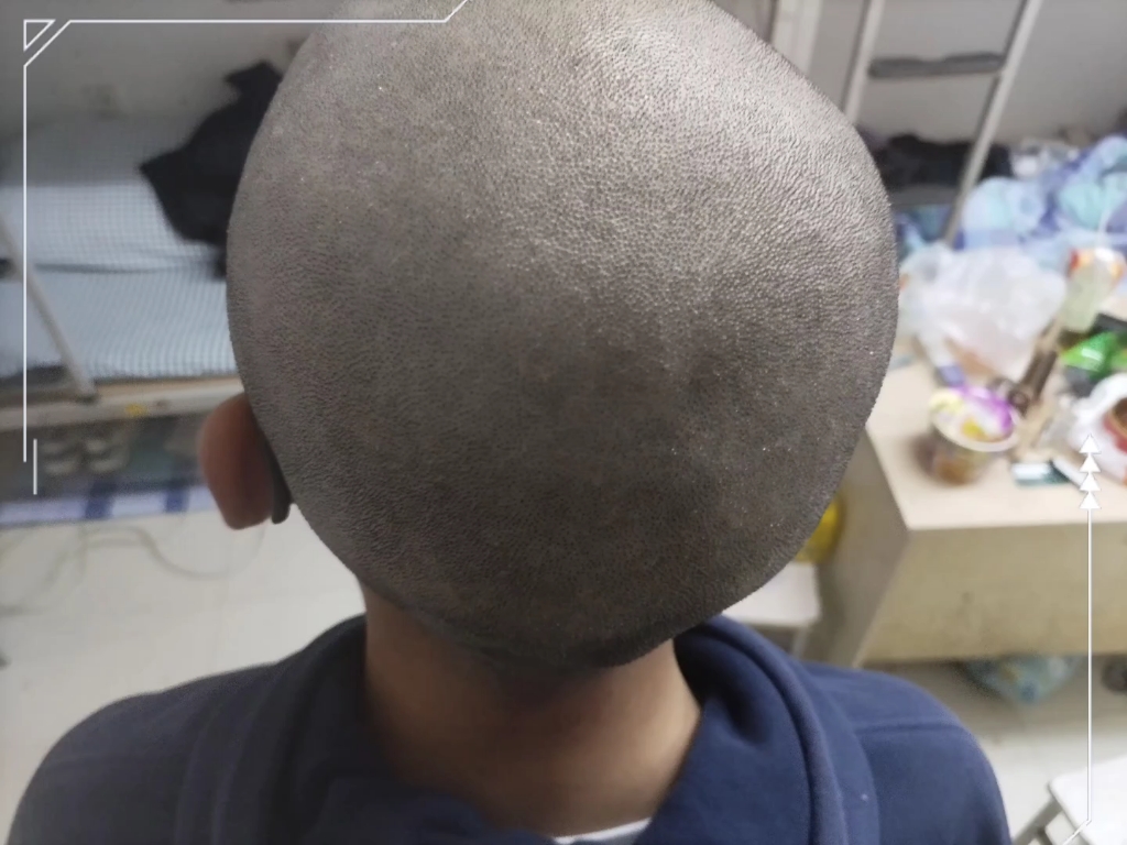 剃光头的好处!