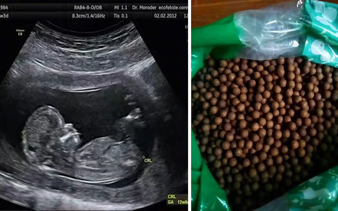 为挽回丈夫吃转胎药生男孩结果还是女孩