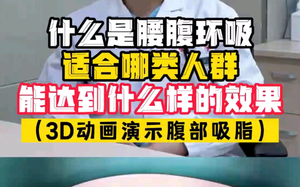 很多网友问,什么是腰腹环吸,自己适不适合,做完能达到什么效果,3D动画演示腹部吸脂哔哩哔哩bilibili