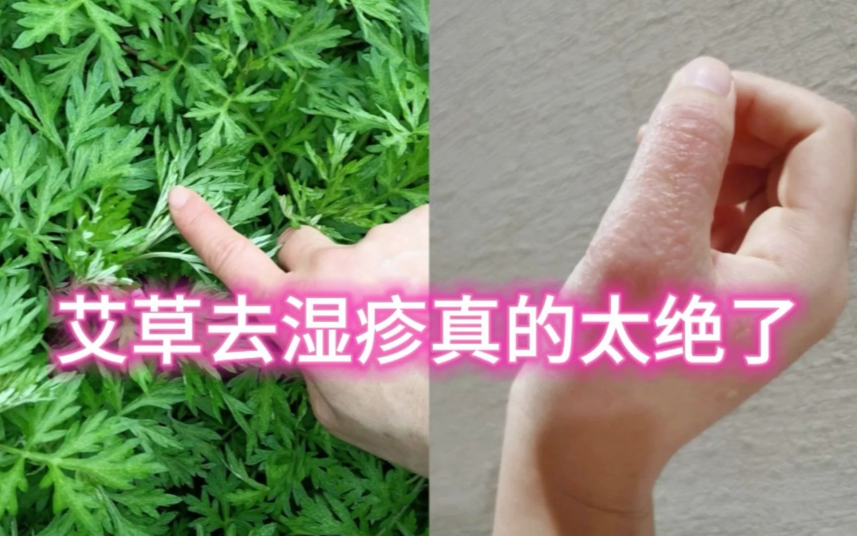 我服了.艾草去溼疹太牛了,溼疹瘙癢全斷根了