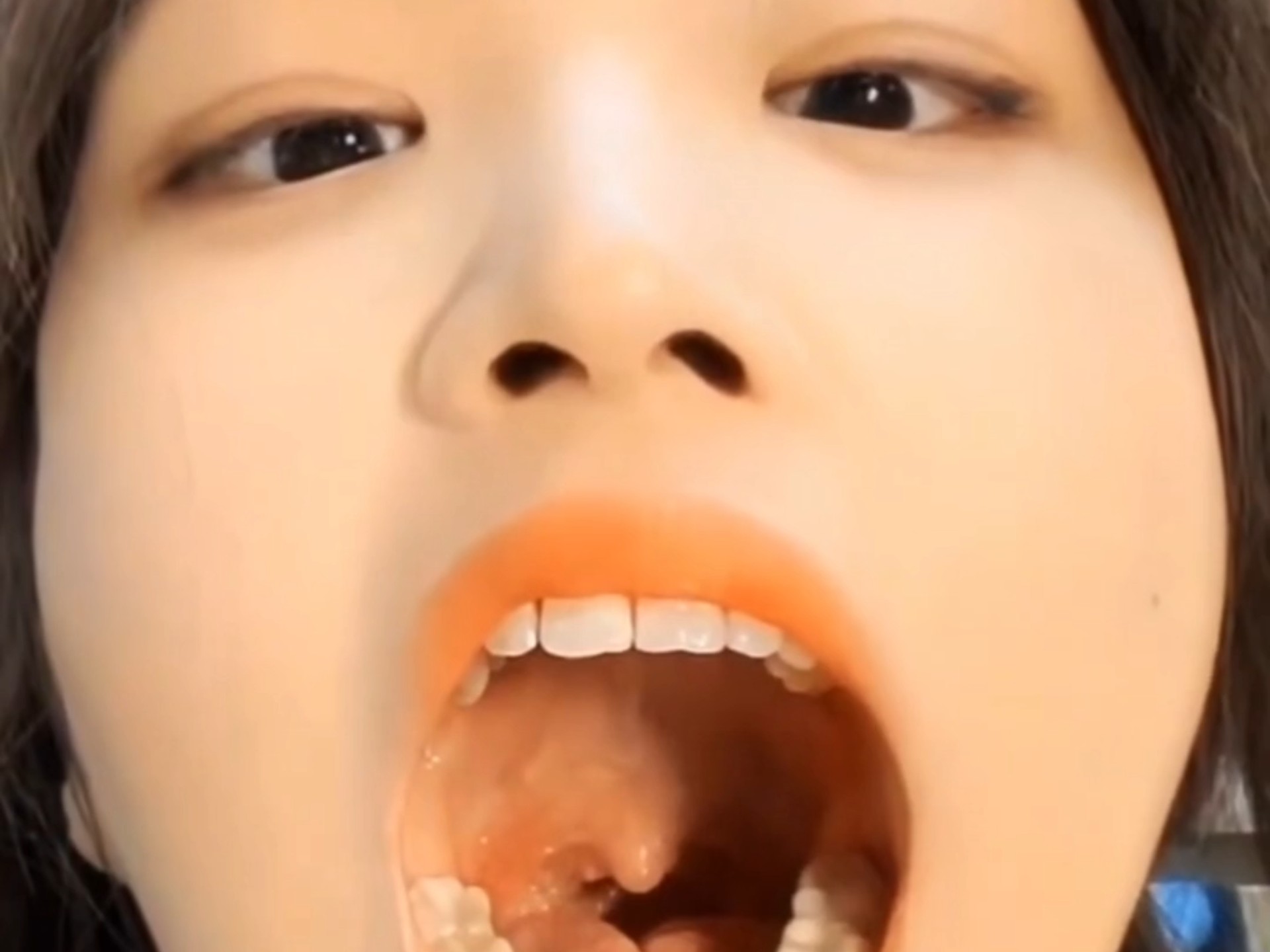 学妹扁桃体发炎自查