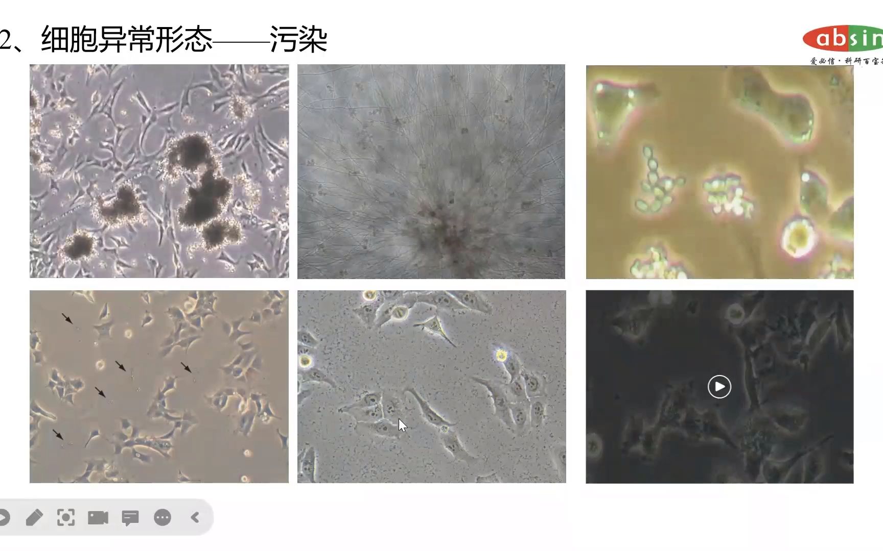 细胞形态异常——污染哔哩哔哩bilibili