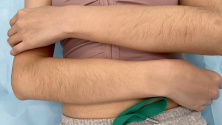 手臂毛太多怎么办?这就告诉你