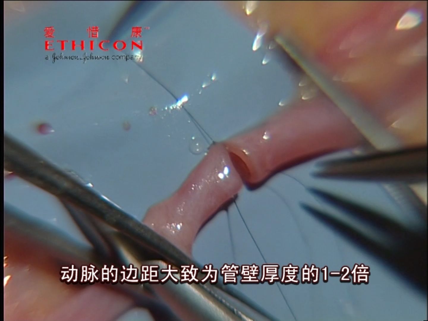血管缝合