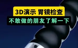 胃镜检查很痛吗？现在有无痛胃镜。可以了解一下