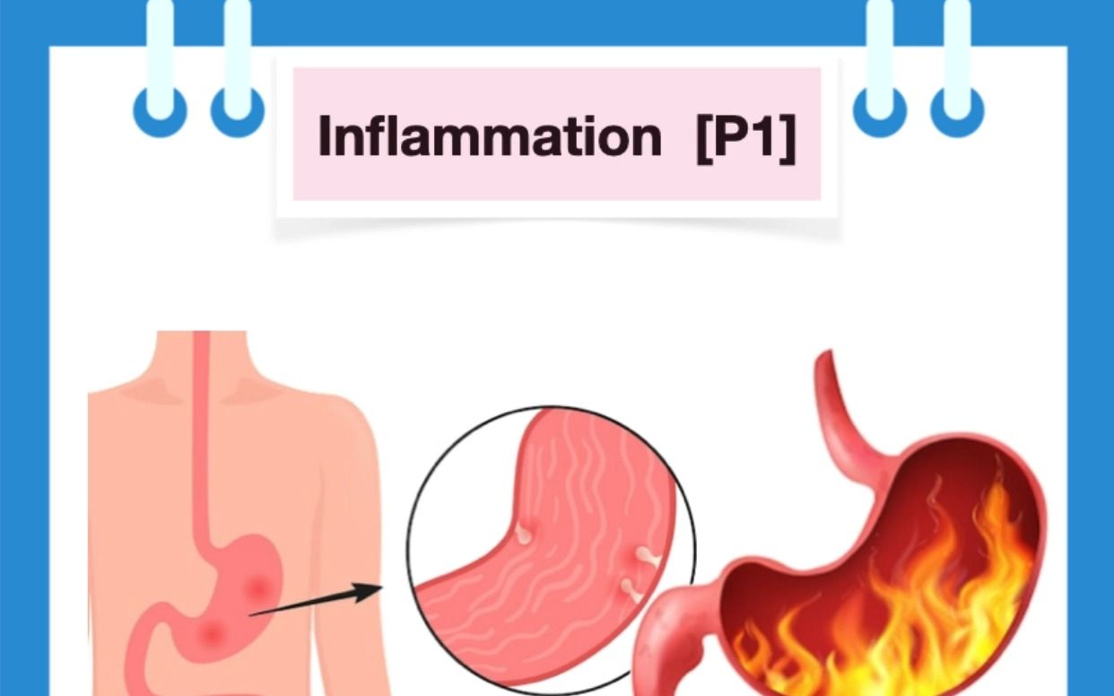 与炎症相关的医学英语术语 | 什么是炎症?哔哩哔哩bilibili