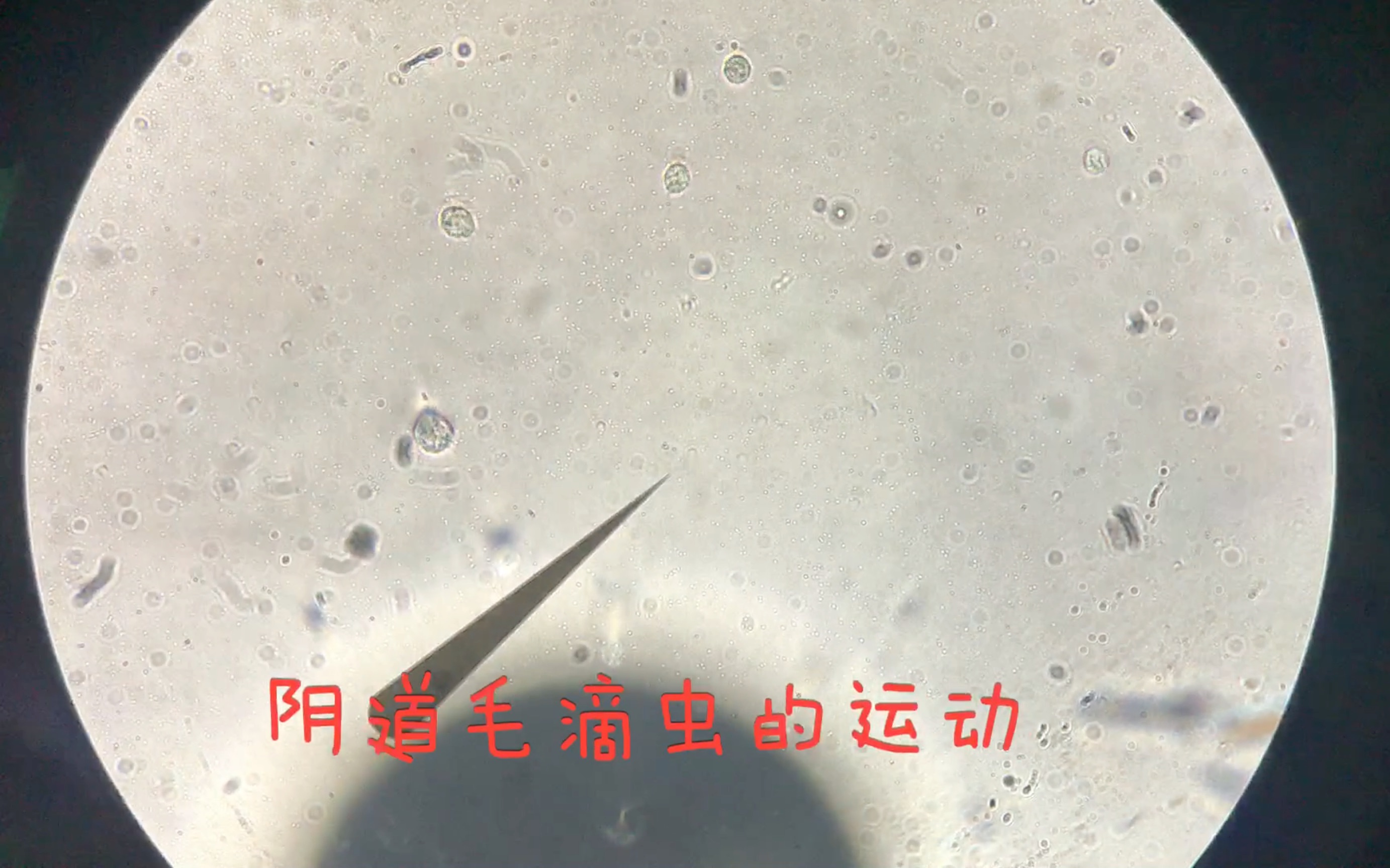 滴虫显微镜下图片图片